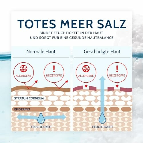 Diagram van huidlagen en vochtbalans